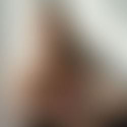 Rust na loslaten van spanning