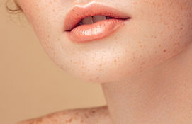 Freckled Skin