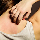 Allergic Reaction