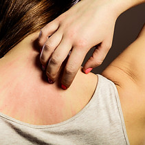 Skin Issues