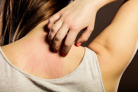 PPD Hair Allergy? Use Henna as Hair Dye! Rock Awesome Hair Color, Safely!