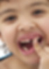 Dientes caídos
