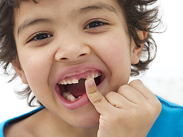 Tooth Extraction