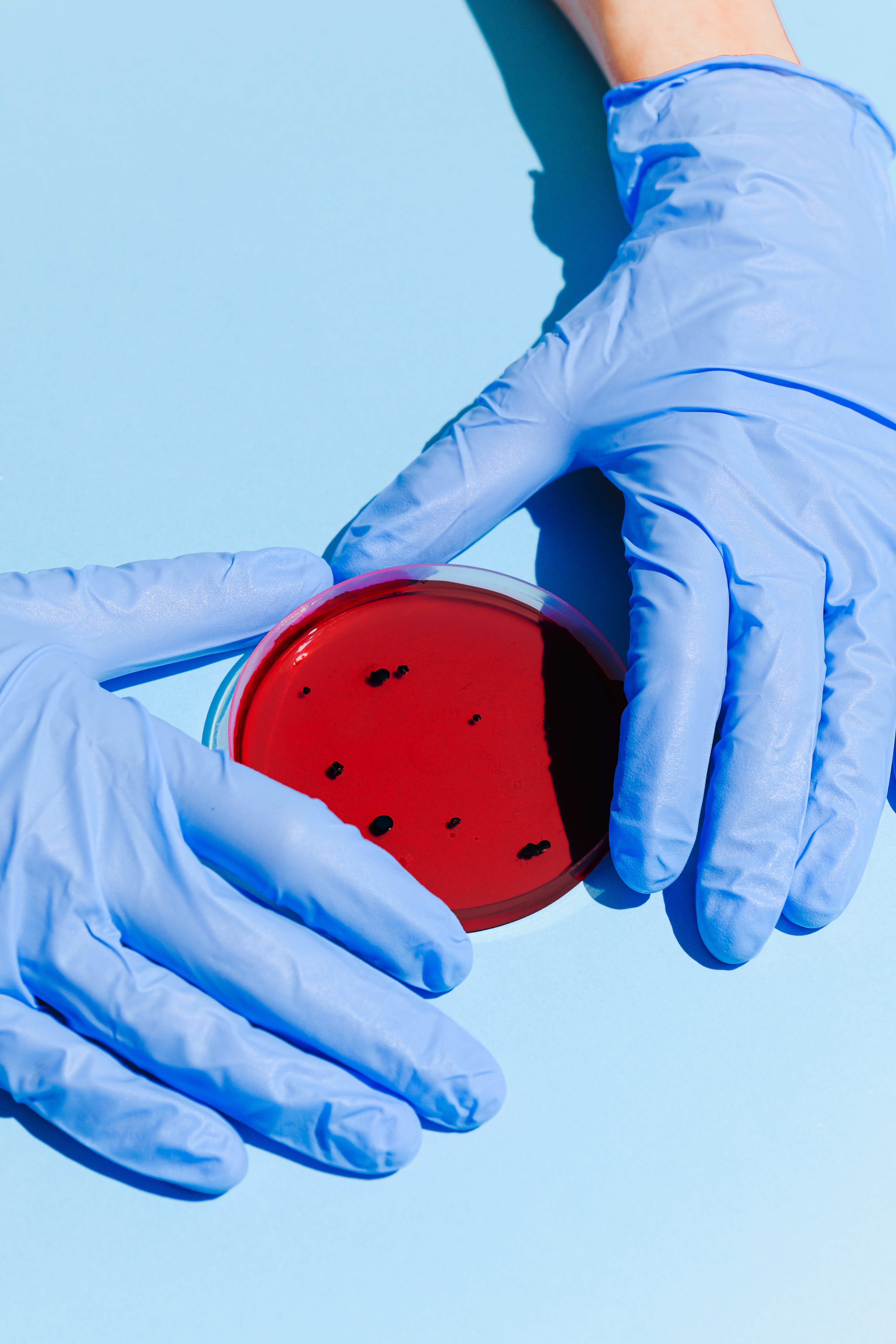 Petri Dish Examination