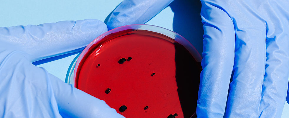 Petri Dish