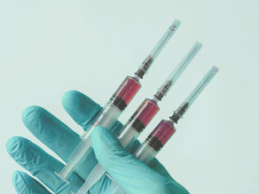 If you’re considering microneedling with PRP or PRF at a medical spa in Miami, FL, it’s important to understand that not all results are the same. Your platelet health and the way your blood is drawn and handled can significantly influence the effectiveness of your treatment.