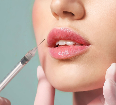 Lip Injection Procedure