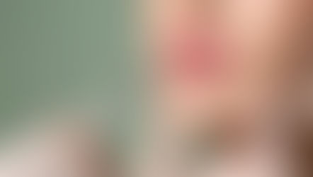 ¿En qué han cambiado los tratamientos para el aumento de labios?