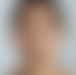 Preventing & Reversing Premature Aging with Micronutrients and Complex Lipotropic Formulas at Black Label Lipo