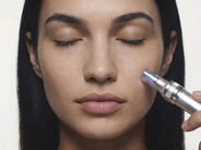 Dermapen işlemi yapılan bir kadın suratı.