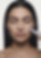 Botox Treatment