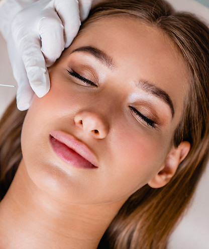 Botox Treatment