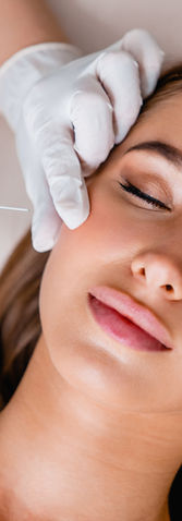 Botox Treatment