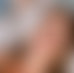 Botulinum Toksin öncesi ve sonrası yapılacaklar hakkında başucu rehberi