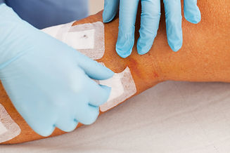 Nurse is taking care of patient