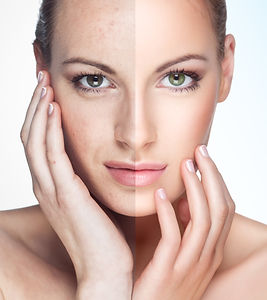 Before and after