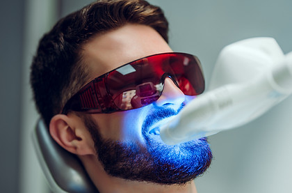 Procedura di sbiancamento dei denti