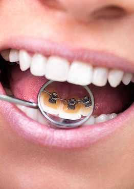 Revisión dental