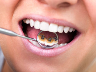 Women having a dental check up in the menopause
