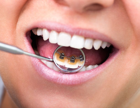 Dental Check