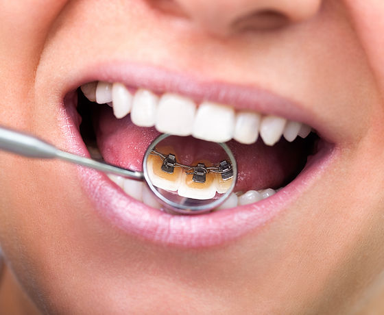 Dental Check