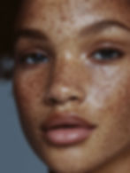 Beautiful girls face with freckles. Face Food Serum with Bakuchi Oil, Vitamin C & Frankincense