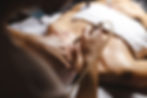 Young woman receiving laser treatment