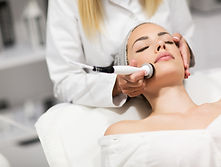 Bild einer kosmetischen Needling behandlung