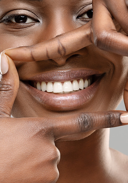 Controllo del sorriso