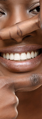 Smile Check