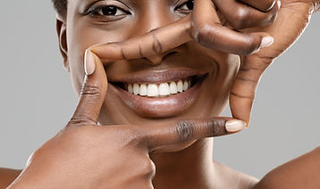 Framing A Smile