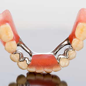 Dental bridge