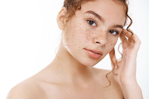 woman with freckles
