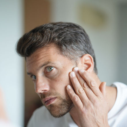 Pattanás vagy akne? – Mikor érdemes bőrgyógyászhoz fordulni?