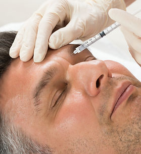 infiltración de toxina botulínica o botox