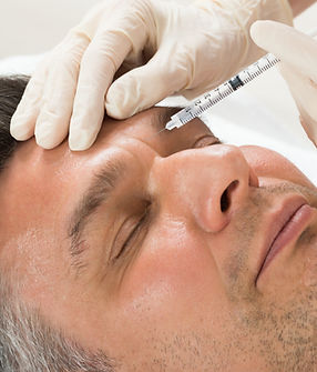 Botulinum toxin (botox) mot rynkor