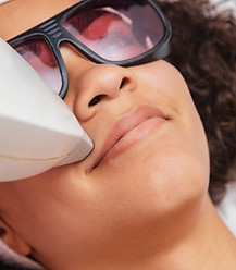 Laser Skin Treatment