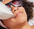 Bovenlip laserontharing