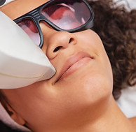 Laser Skin Treatment