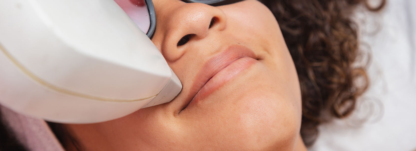 laser hair removal near me, atlanta laser hair removal, hair removal services Snellville GA