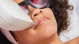 Person wearing protective goggles receives facial laser treatment, lying on a white surface. Mood appears calm; close-up shot.