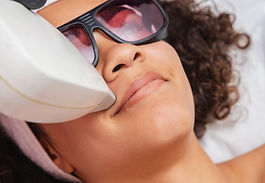 Depilação a laser do lábio superior