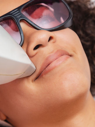 Laser Hair Removal