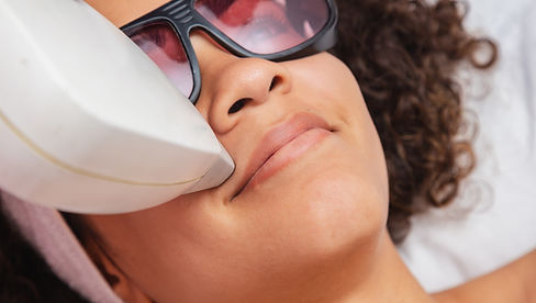 Upper Lip Laser Hair Removal