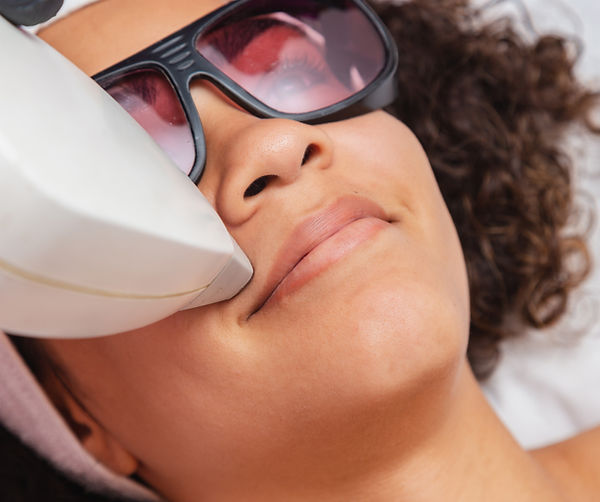 Laser Skin Treatment