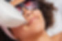 Upper Lip Laser Hair Removal