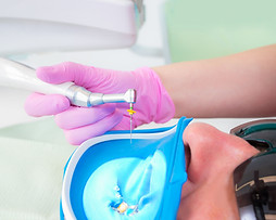Root Canal Treatment