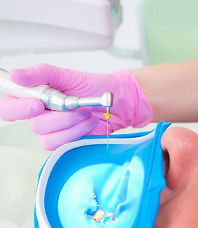 Root Canal Treatment