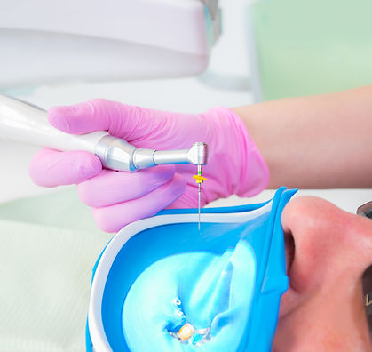 Primo piano della procedura dentale