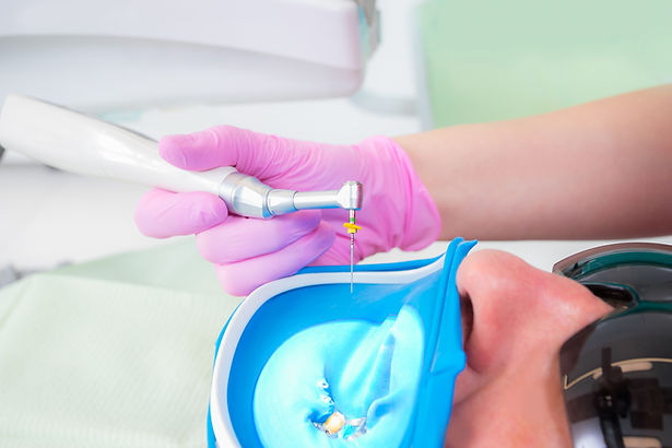 Root Canal Treatment